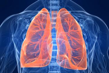Λοιμώξεις Αναπνευστικού-Πνευμονία-Πλευρίτιδα